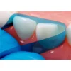 50pcs Blue Restoration Dental Contoured Anterior Resin Matrix Bands - view 4 TA061 50-Piece Contoured Anterior Resin Matrix Band Set — detail view 4